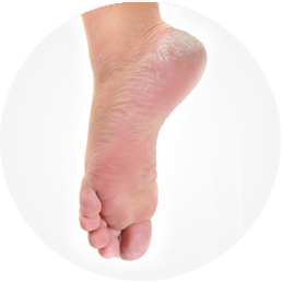 podologie soins des pieds