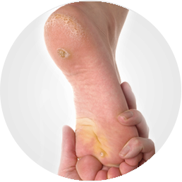 podologie, soin des pieds