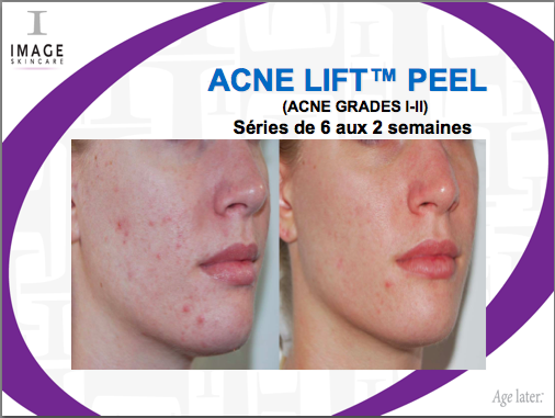 avant-apres Image Skincare