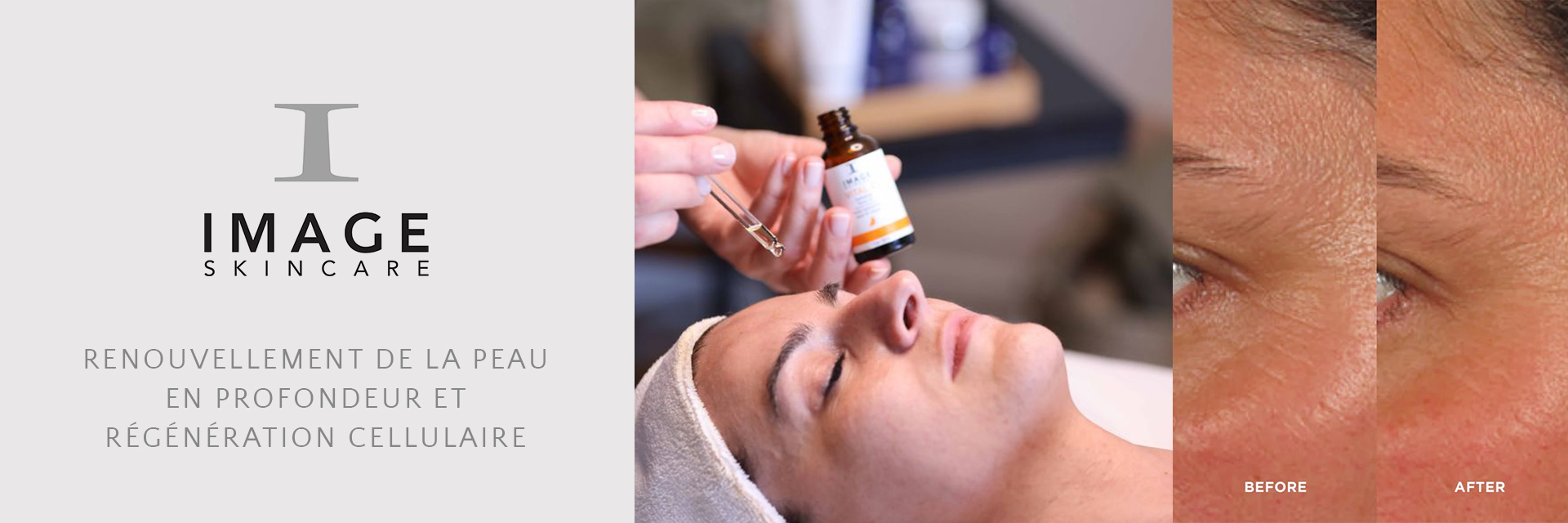 Image Skincare Peeling chimique